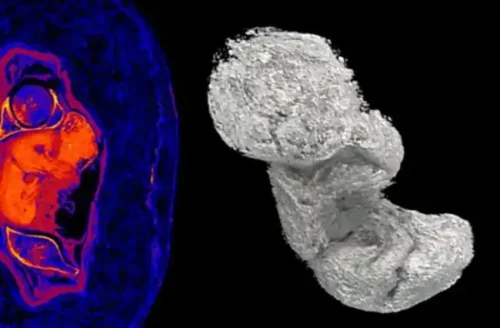 Polonia- mummia egizia di donna incinta